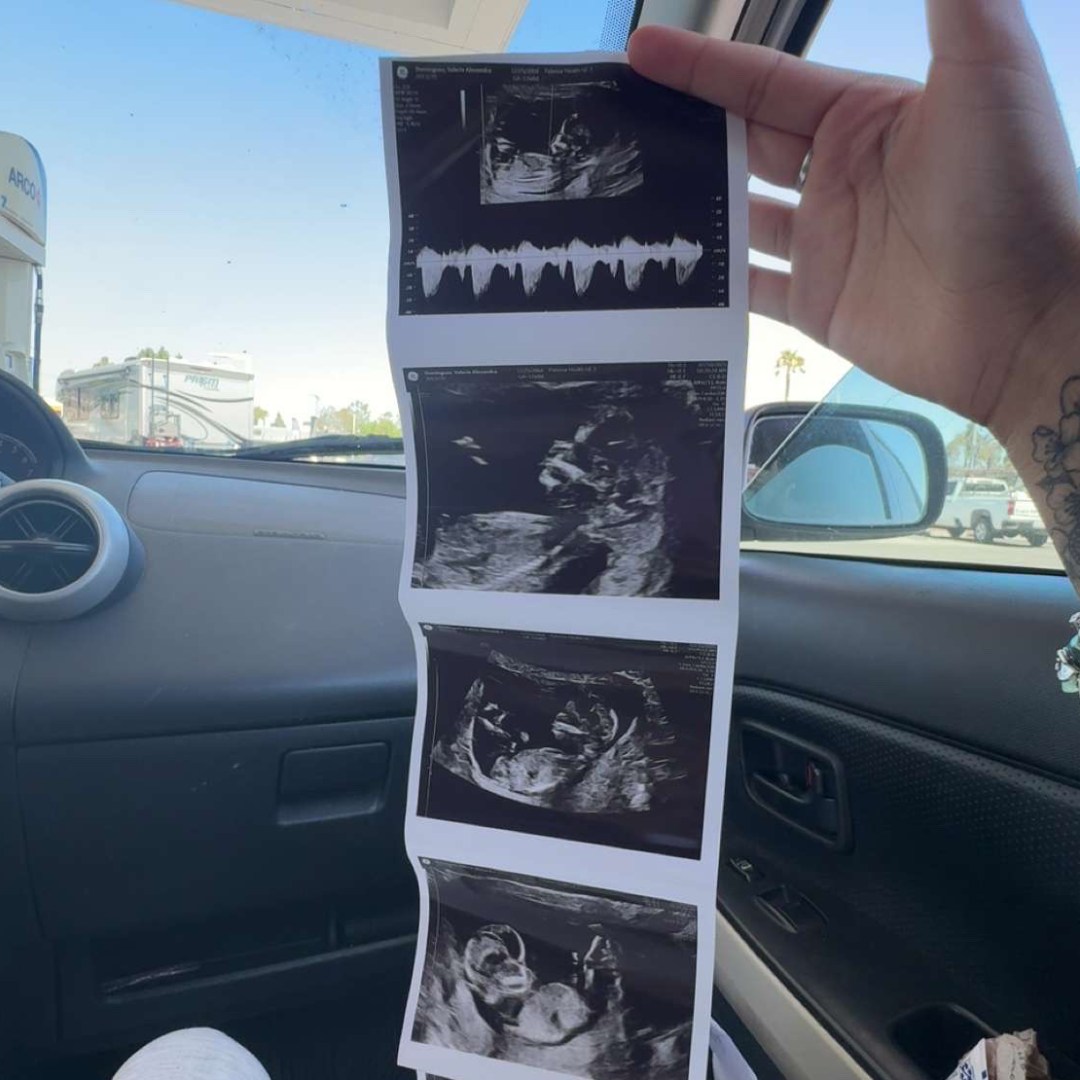 Photo shared by Valerie for their Babylist baby registry.