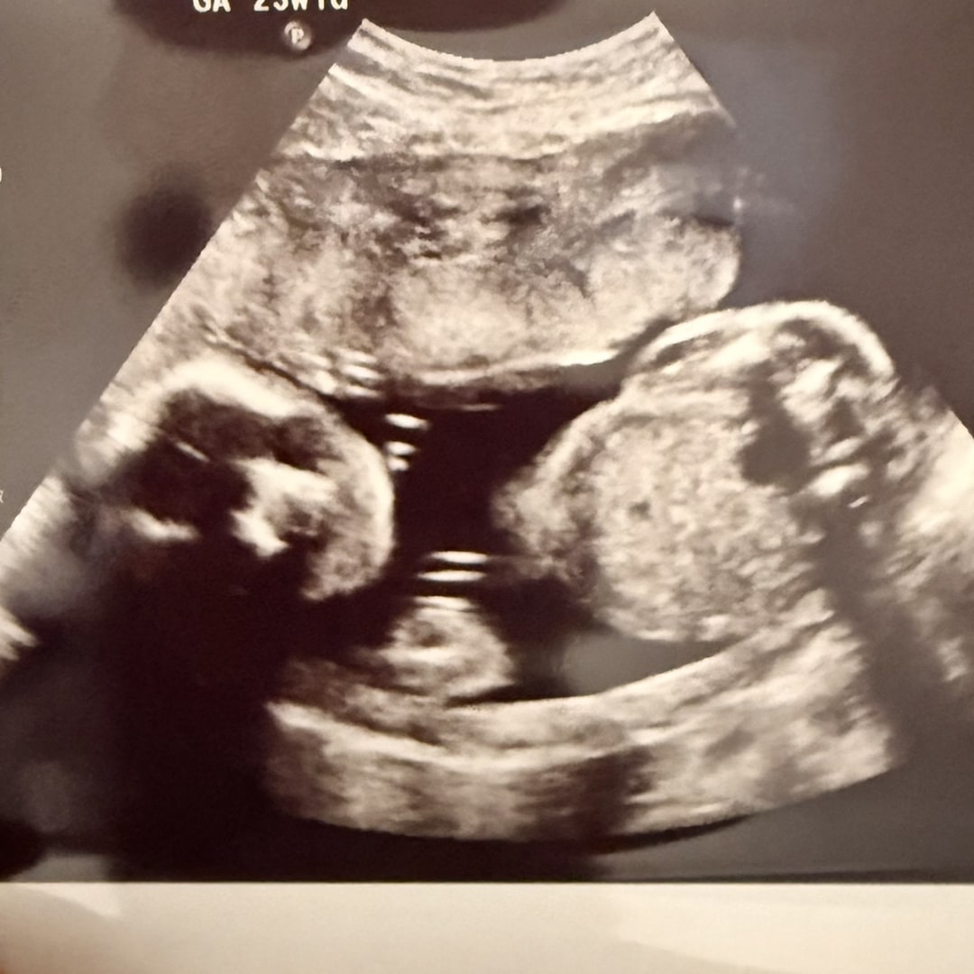 Photo shared by Jazmine for their Babylist baby registry.