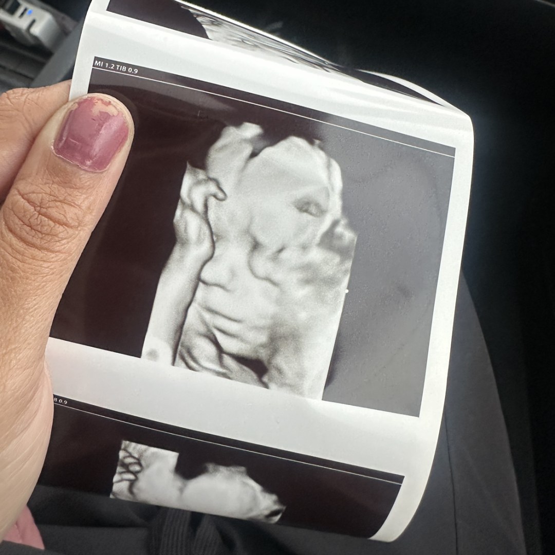 Photo shared by Tree for their Babylist baby registry.