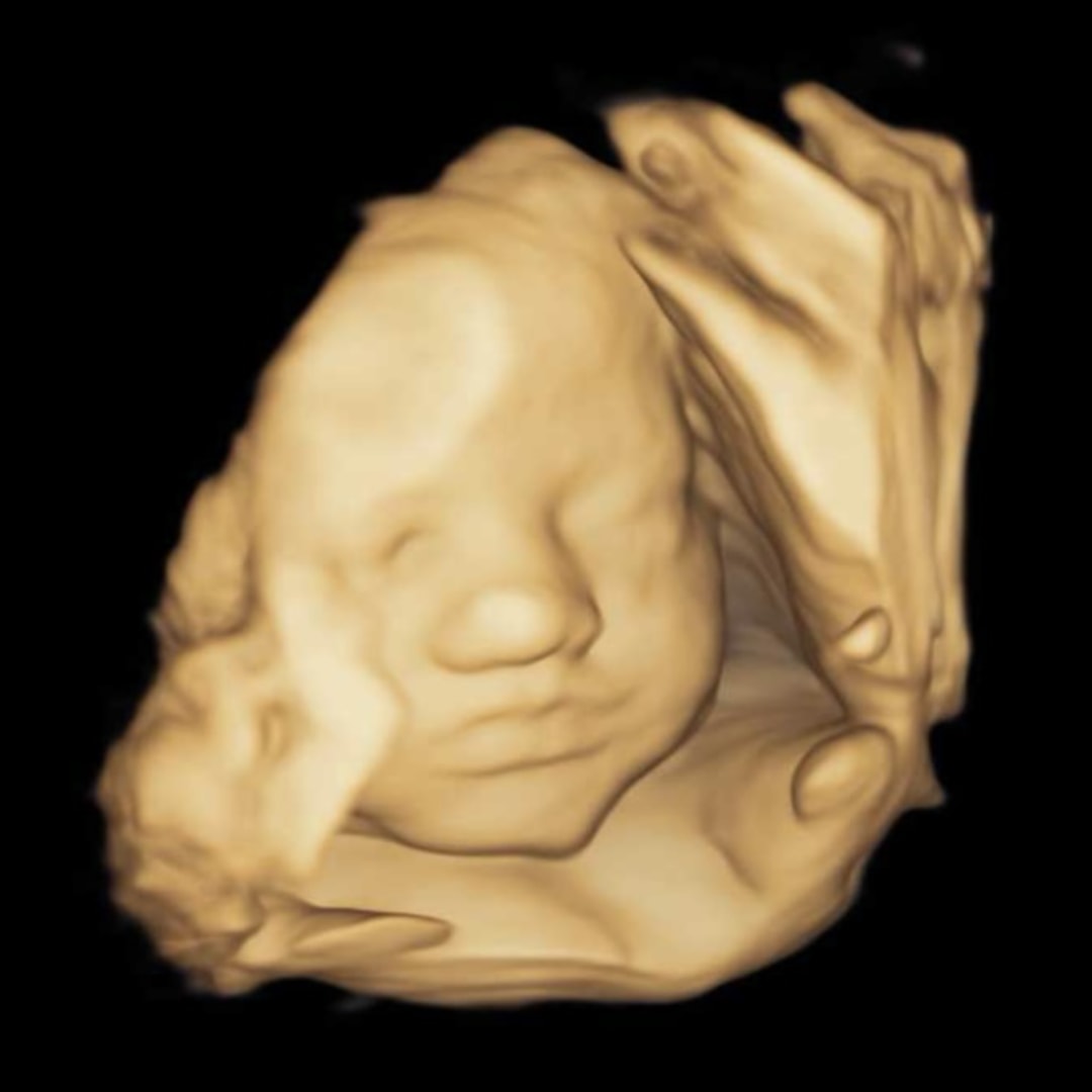 Photo shared by Breanna for their Babylist baby registry.