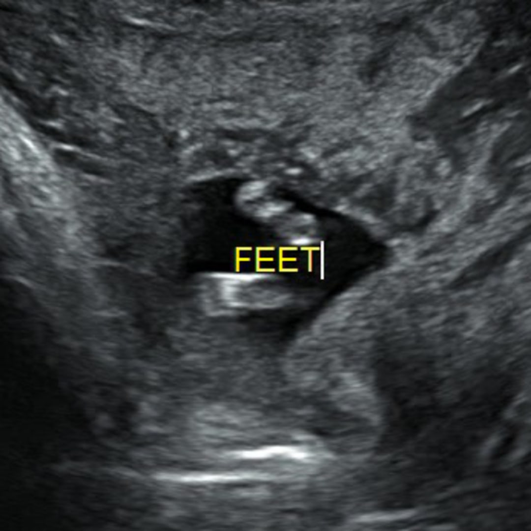 Photo shared by Dana for their Babylist baby registry.