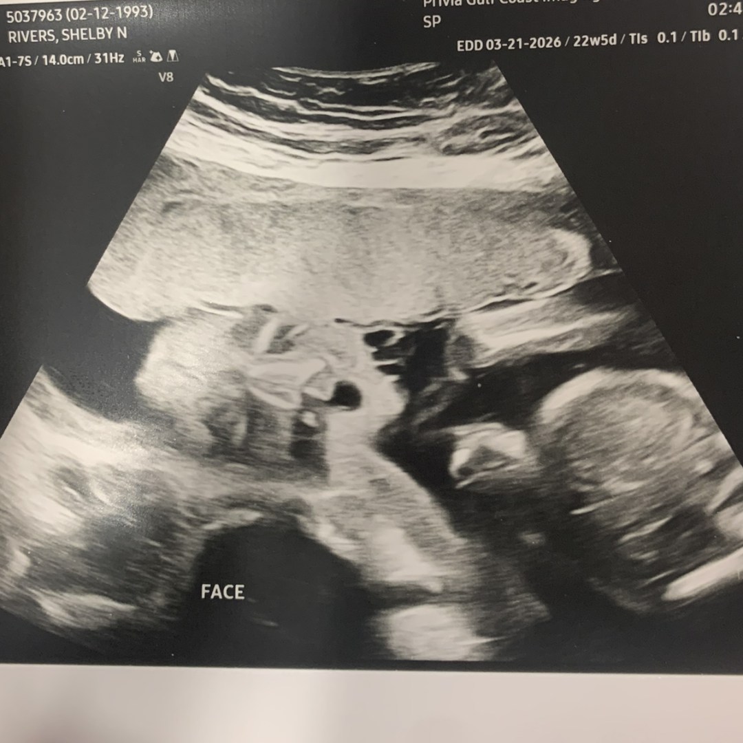 Photo shared by Shelby for their Babylist baby registry.