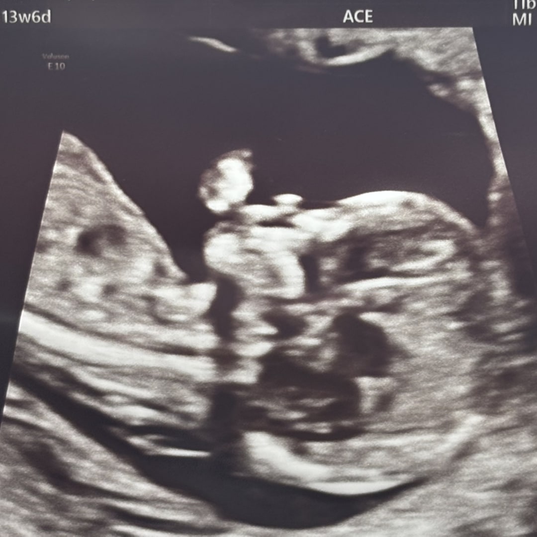 Photo shared by Teirvondria for their Babylist baby registry.