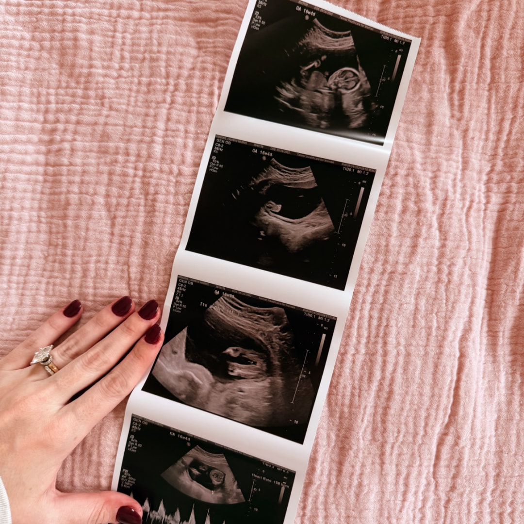 Photo shared by Camryn for their Babylist baby registry.