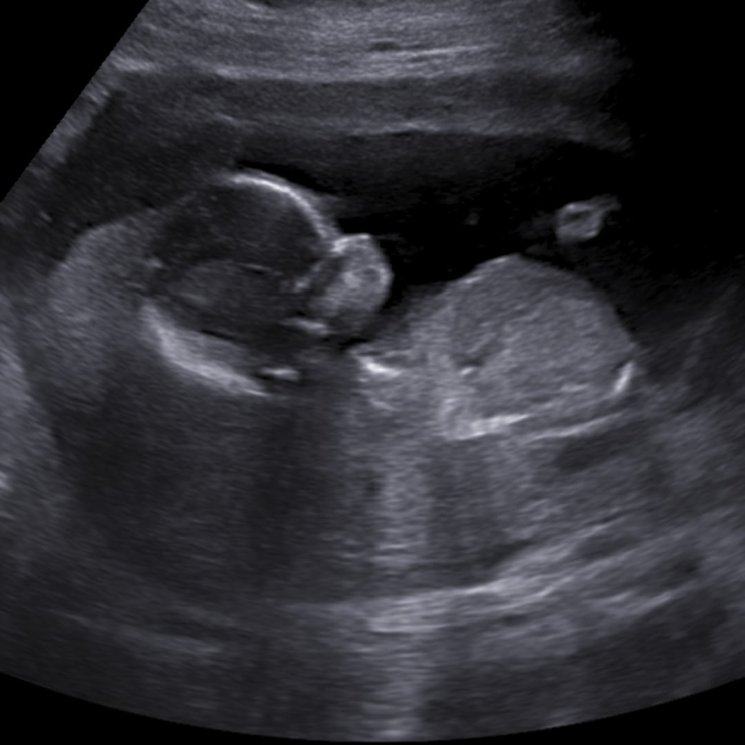 Photo shared by Megan for their Babylist baby registry.