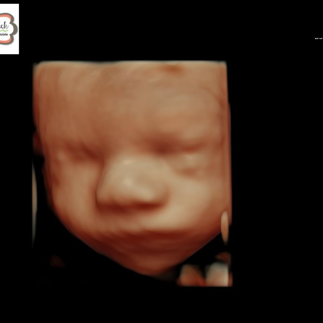Photo shared by Bailey for their Babylist baby registry.