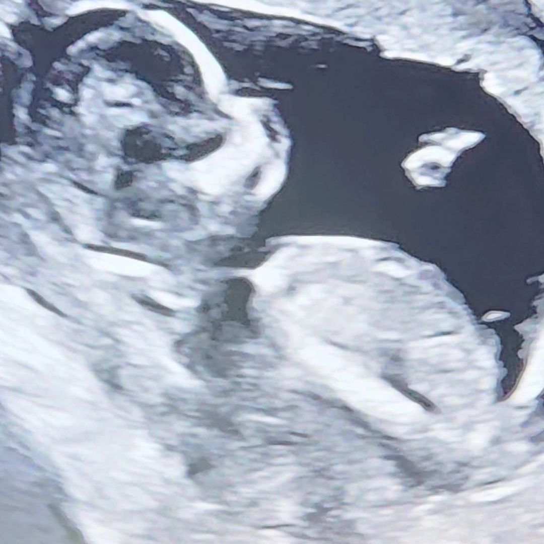 Photo shared by Rachel for their Babylist baby registry.