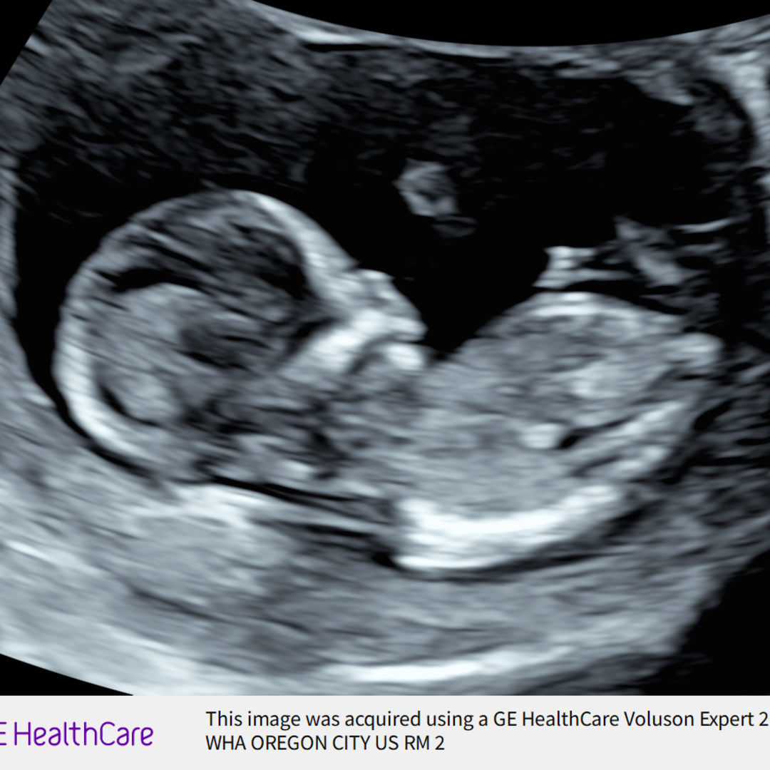 Photo shared by Madison for their Babylist baby registry.