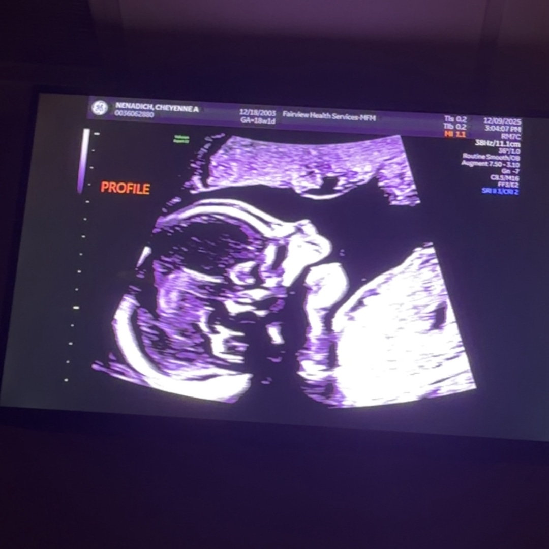 Photo shared by Cheyenne for their Babylist baby registry.