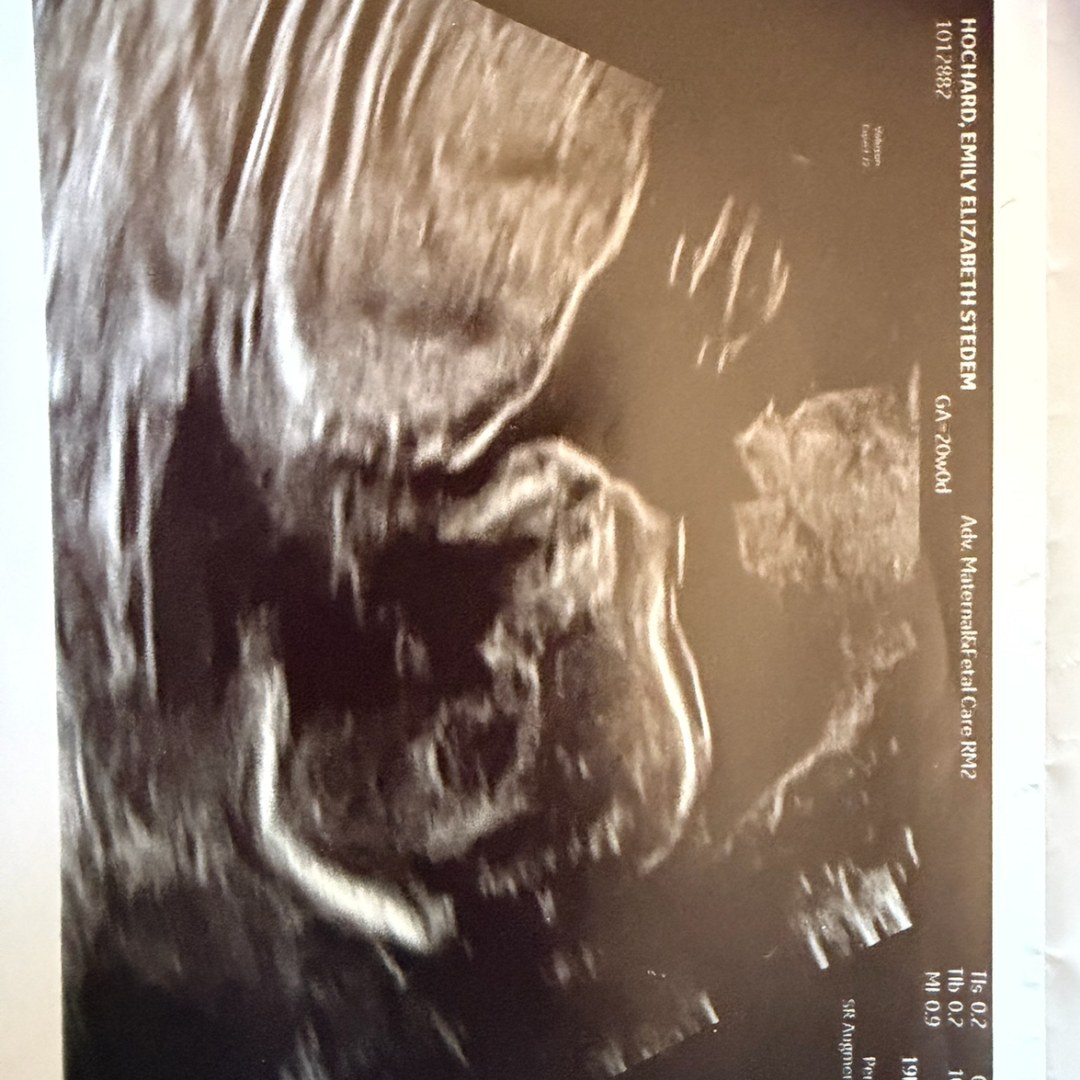 Photo shared by Emily for their Babylist baby registry.