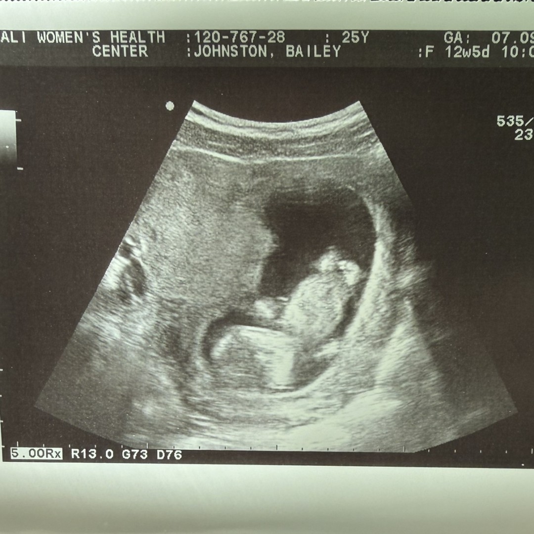 Photo shared by Bailey for their Babylist baby registry.