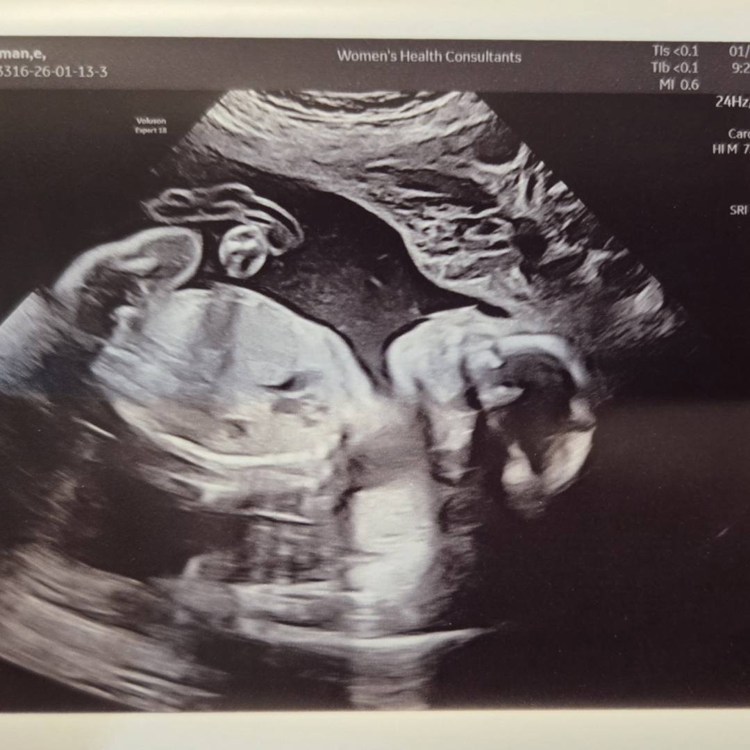 Photo shared by Erica for their Babylist baby registry.