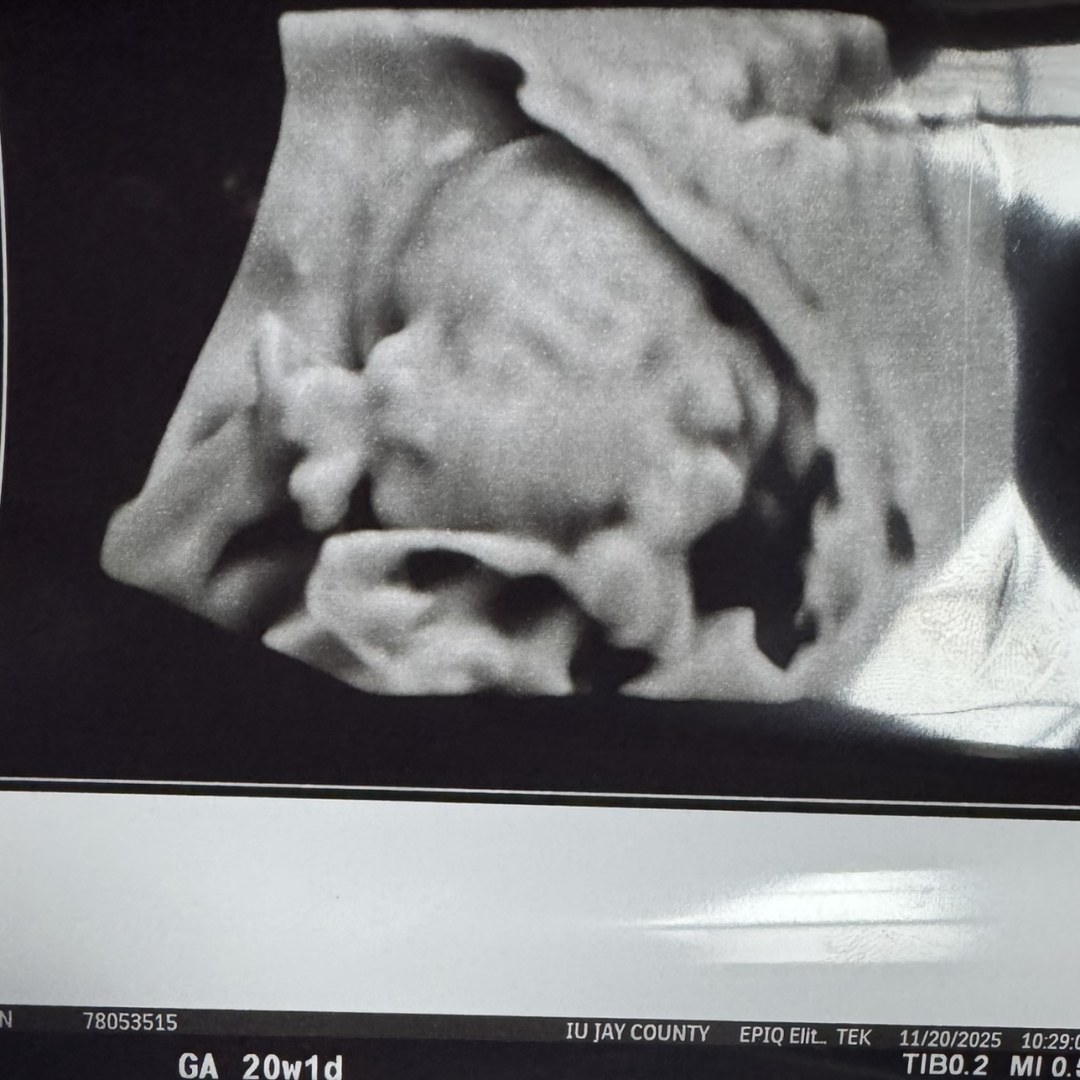 Photo shared by Caitlyn for their Babylist baby registry.