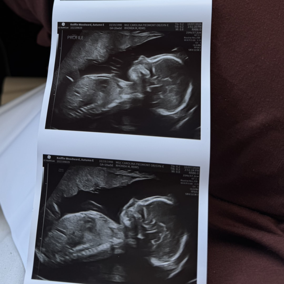 Photo shared by Autumn for their Babylist baby registry.