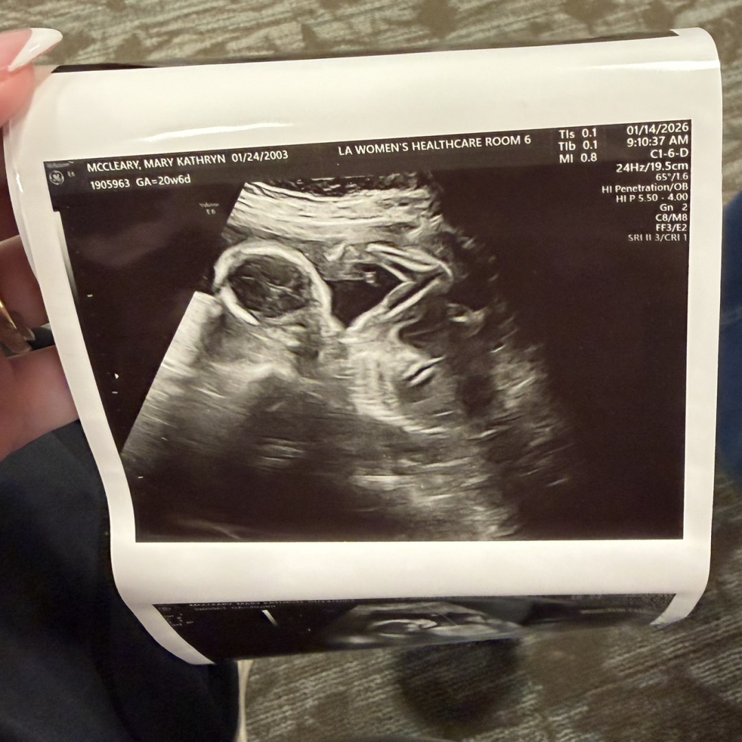 Photo shared by Mary for their Babylist baby registry.