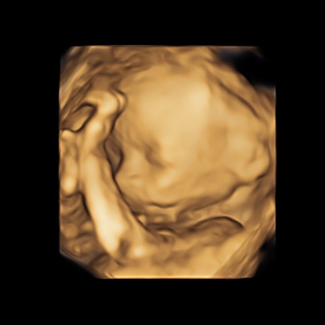 Photo shared by Eliza for their Babylist baby registry.