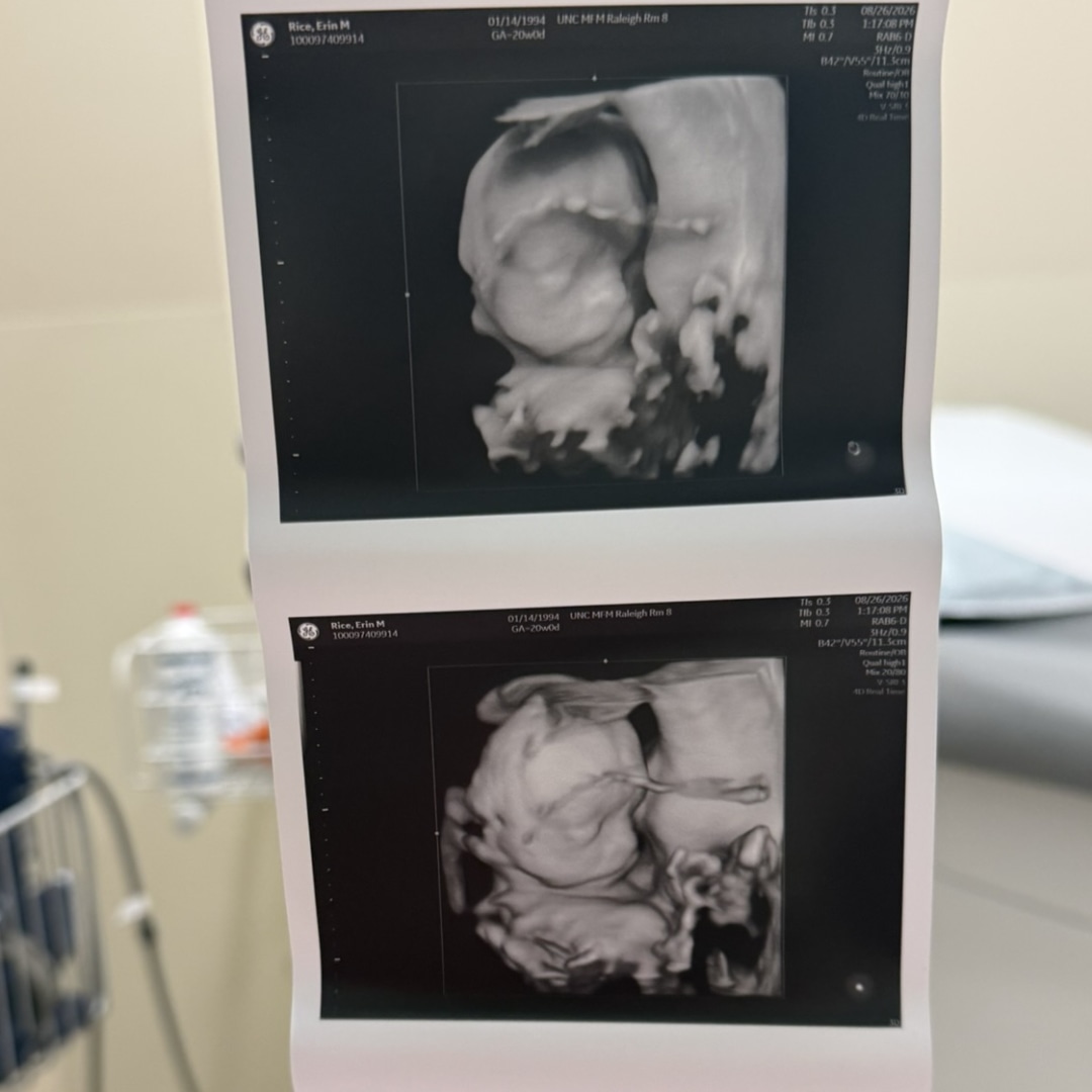 Photo shared by Erin for their Babylist baby registry.