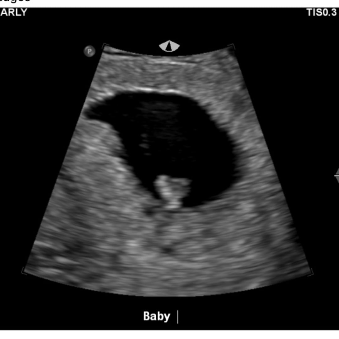 Photo shared by Jillian for their Babylist baby registry.