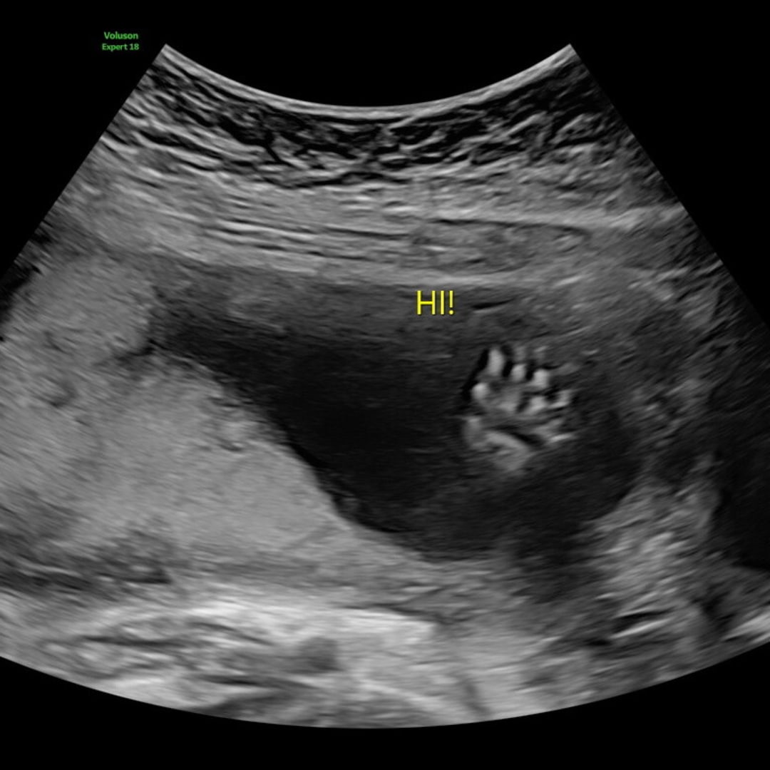 Photo shared by Laura for their Babylist baby registry.