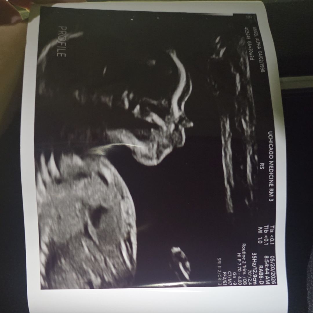 Photo shared by Alpha for their Babylist baby registry.