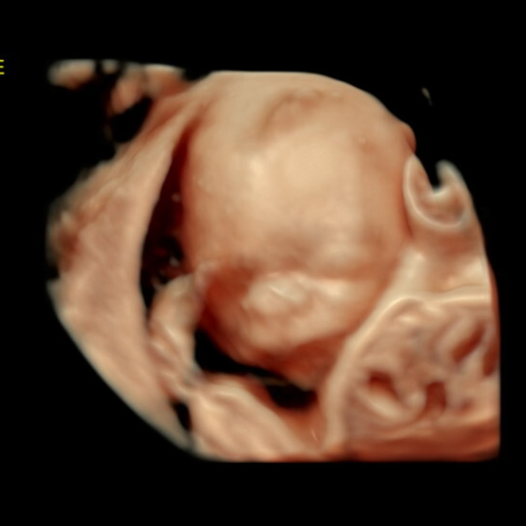 Photo shared by Johanna for their Babylist baby registry.