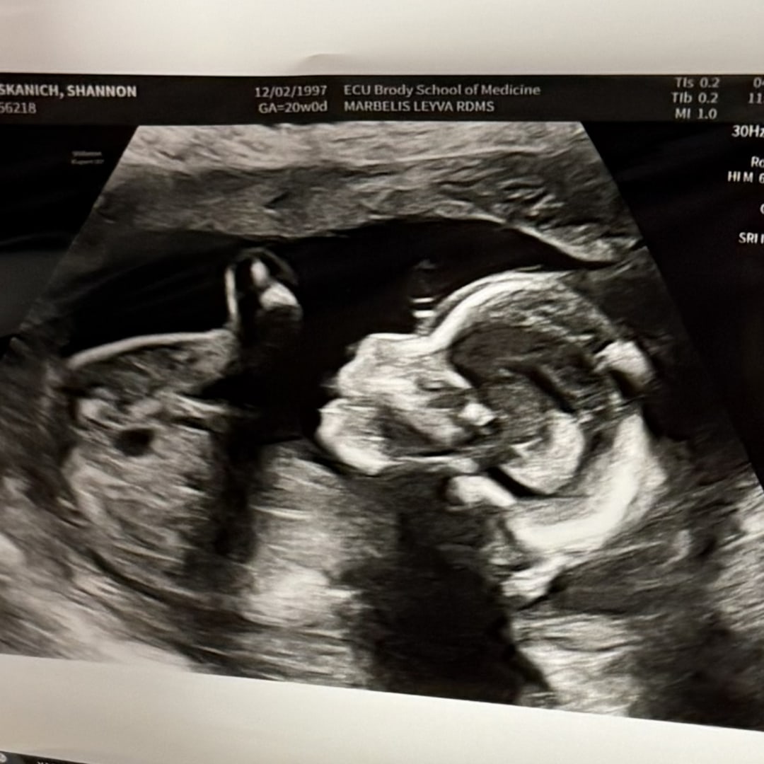 Photo shared by Shannon for their Babylist baby registry.