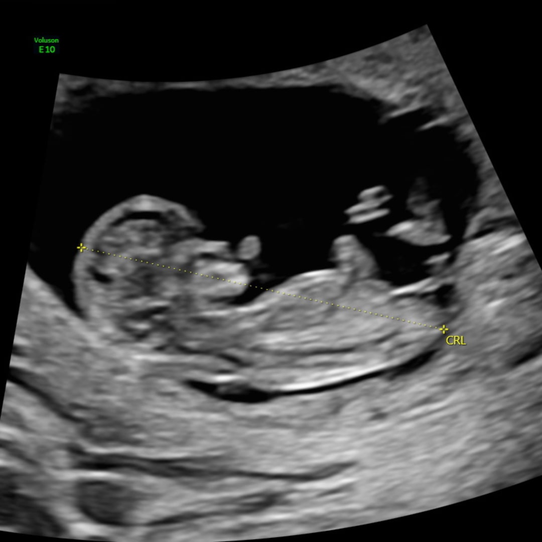 Photo shared by Alyssa for their Babylist baby registry.