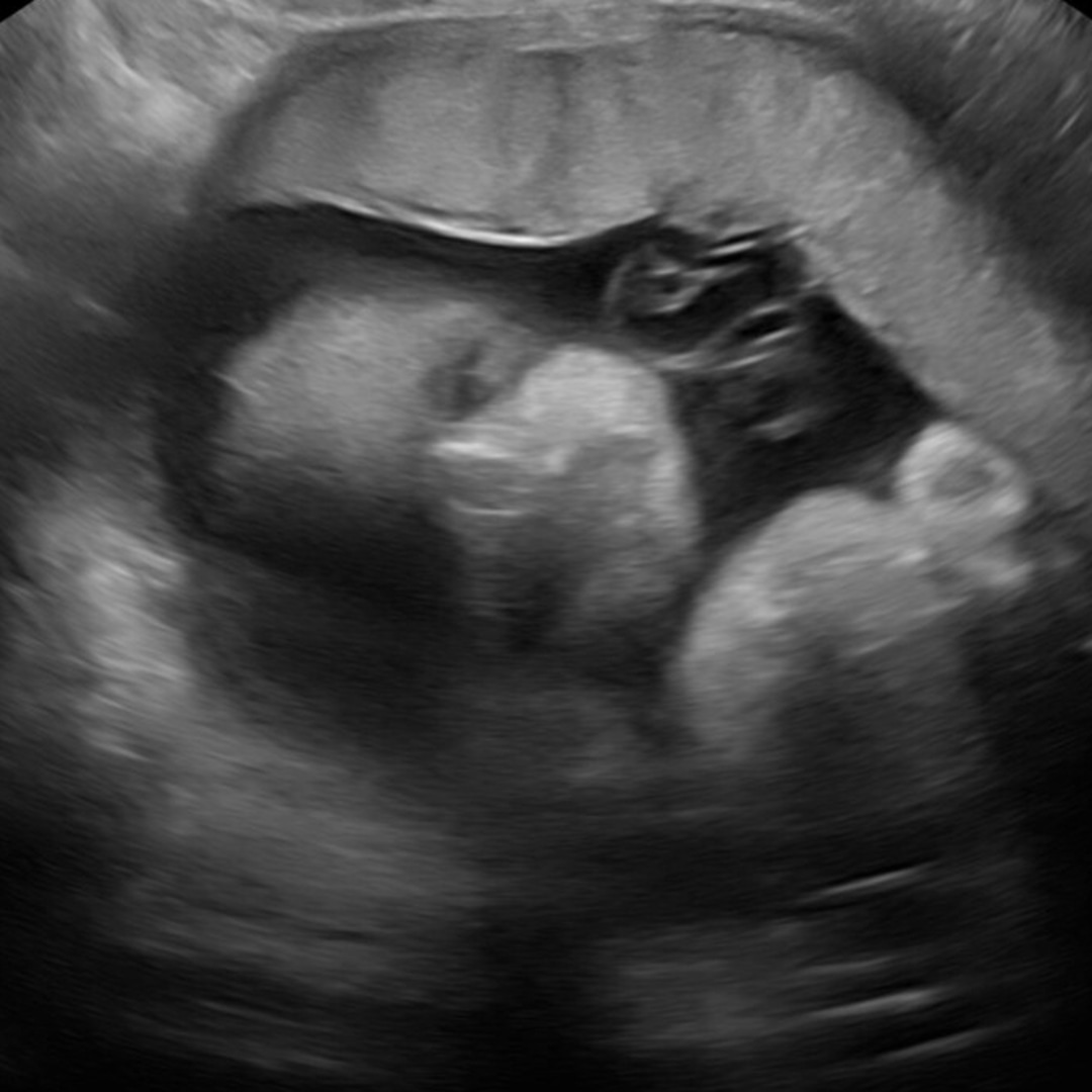 Photo shared by Lindsay for their Babylist baby registry.