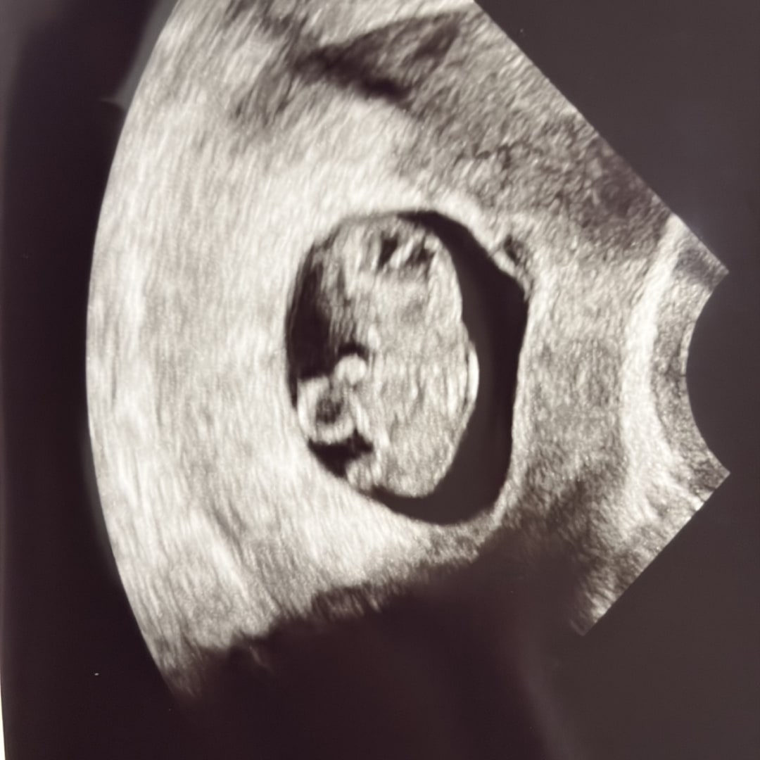 Photo shared by Habakkuk for their Babylist baby registry.