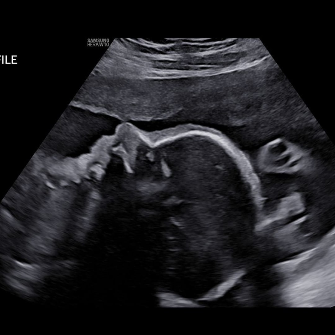 Photo shared by Katie for their Babylist baby registry.