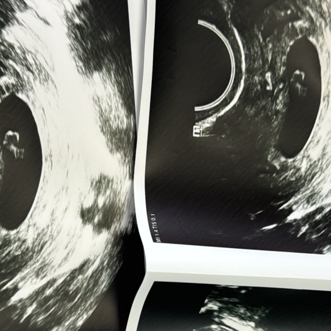 Photo shared by Yuliana for their Babylist baby registry.