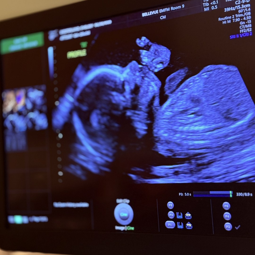 Photo shared by Chelsey for their Babylist baby registry.