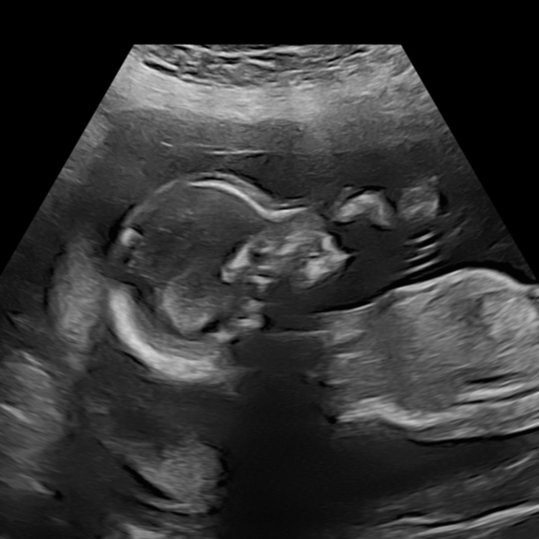 Photo shared by Holley for their Babylist baby registry.