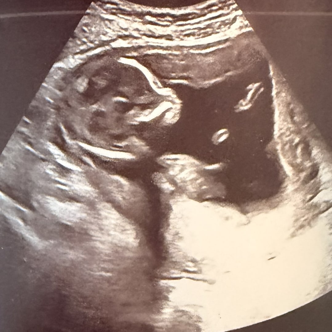 Photo shared by Brigitte for their Babylist baby registry.