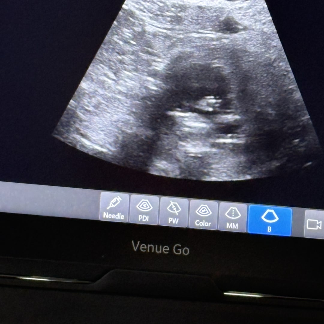 Photo shared by Brandi for their Babylist baby registry.