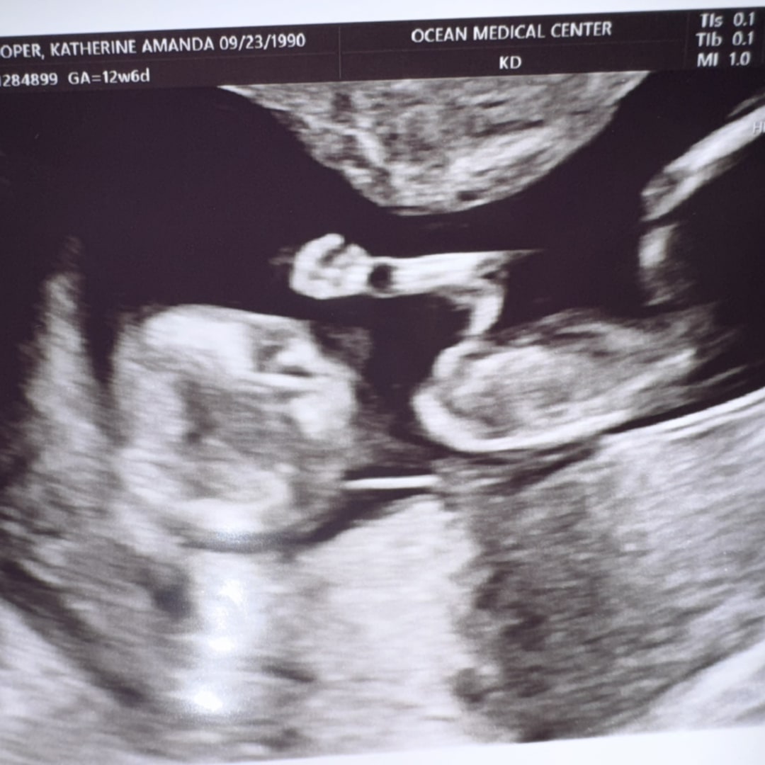 Photo shared by Katherine for their Babylist baby registry.