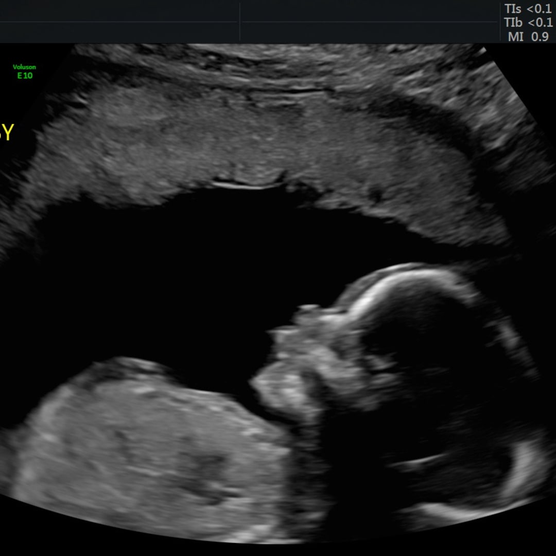 Photo shared by Imani for their Babylist baby registry.