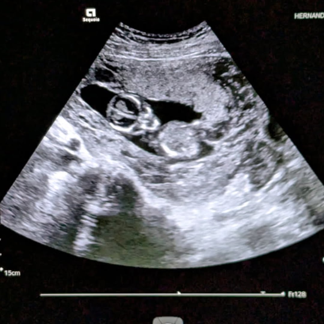 Photo shared by Adriana for their Babylist baby registry.