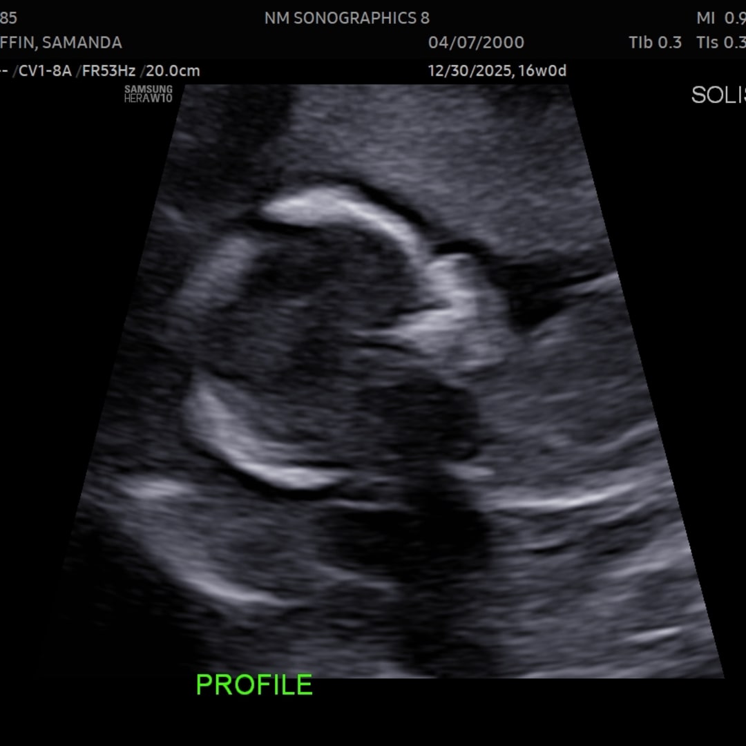 Photo shared by Samanda for their Babylist baby registry.