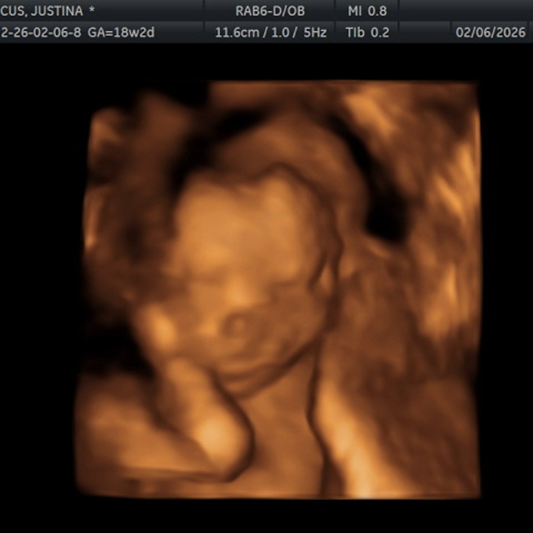 Photo shared by Justina for their Babylist baby registry.