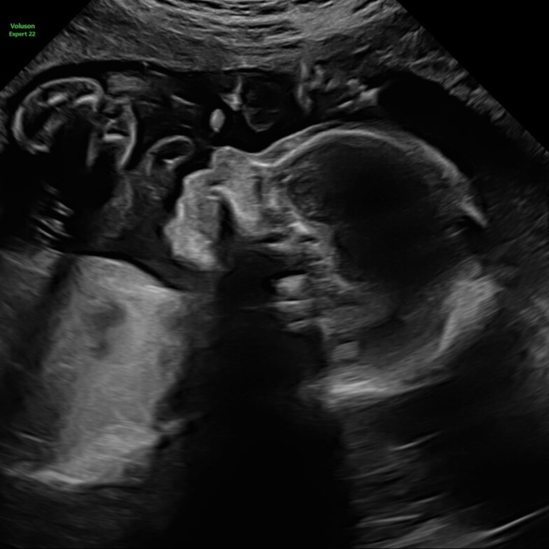 Photo shared by Isabel for their Babylist baby registry.