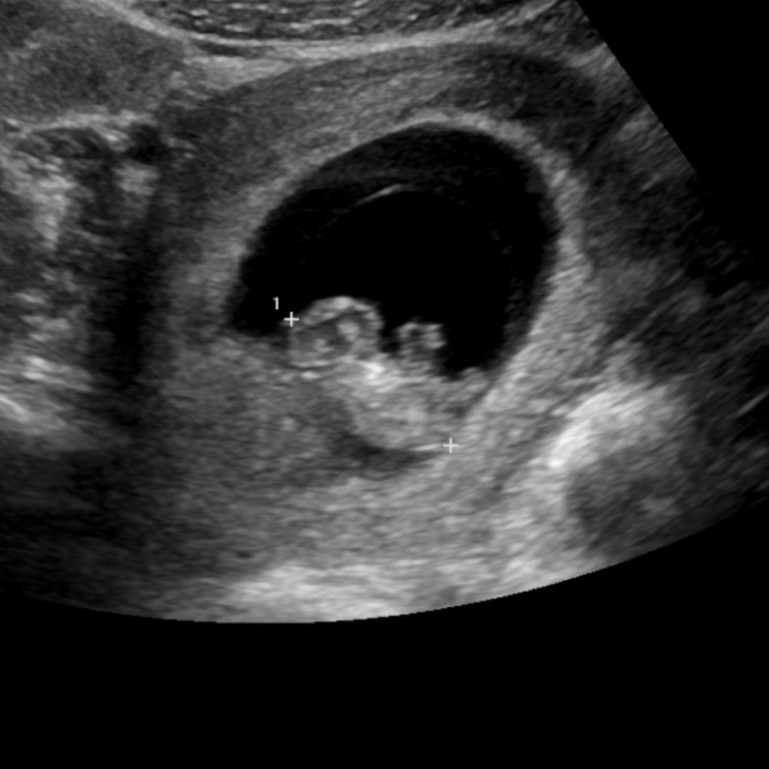 Photo shared by Kay for their Babylist baby registry.