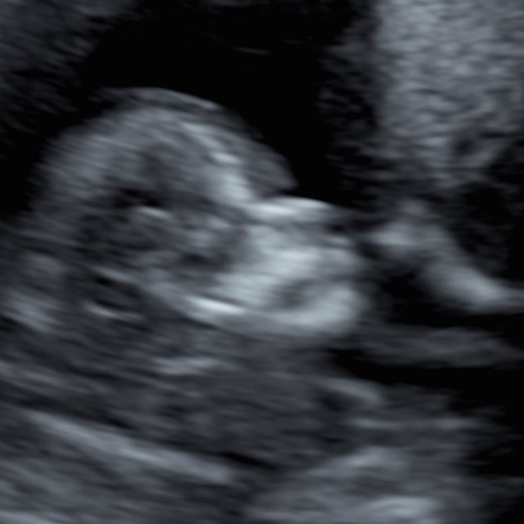 Photo shared by Frances for their Babylist baby registry.