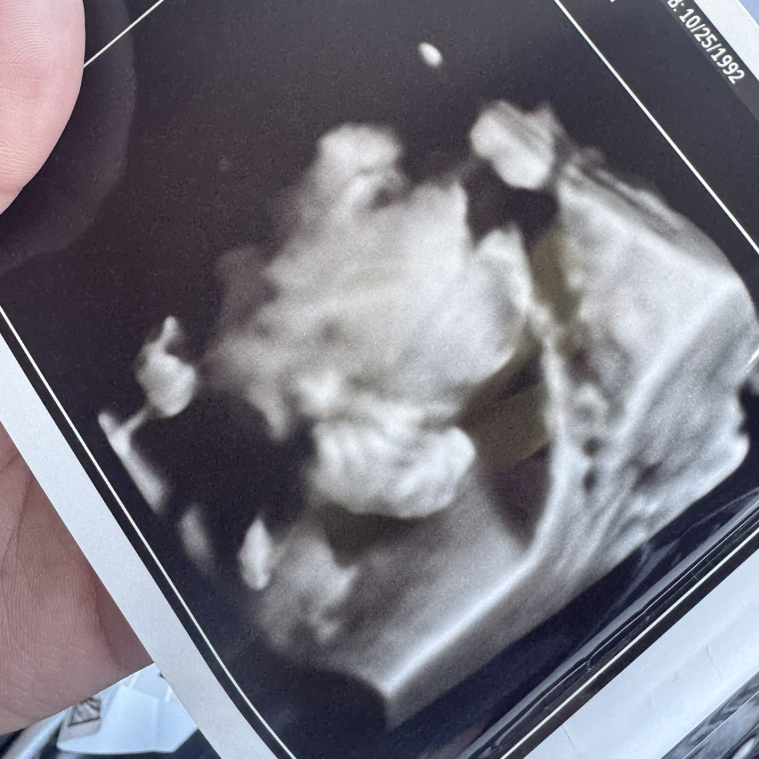 Photo shared by Jenny for their Babylist baby registry.