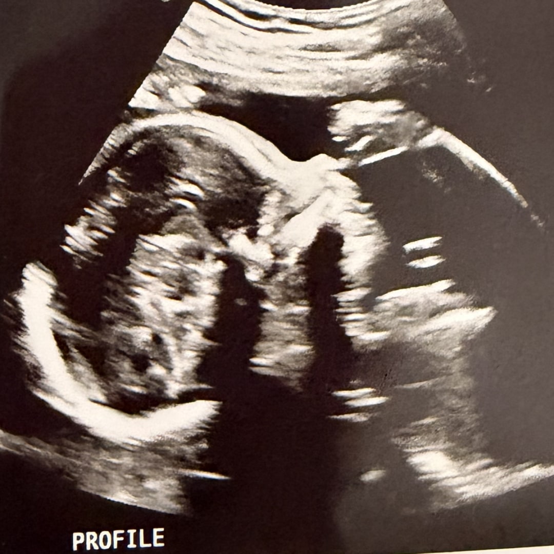 Photo shared by Karly for their Babylist baby registry.