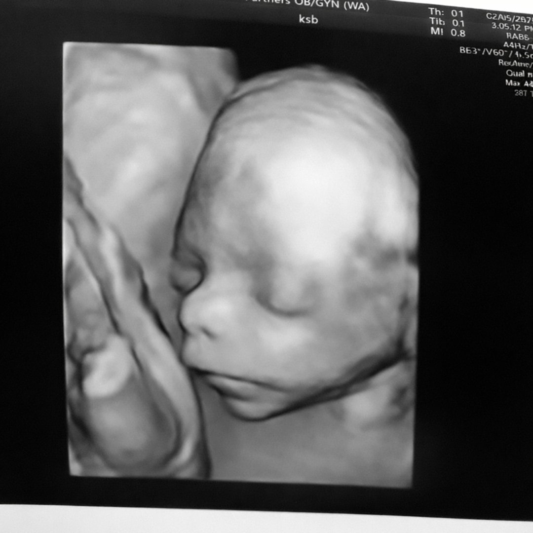 Photo shared by Danielle for their Babylist baby registry.