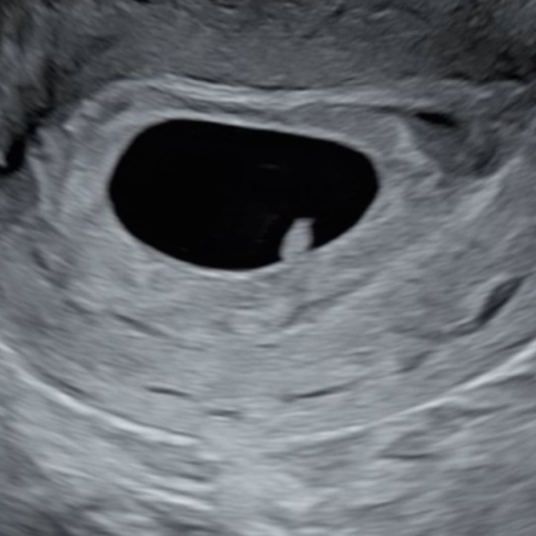 Photo shared by Erica for their Babylist baby registry.