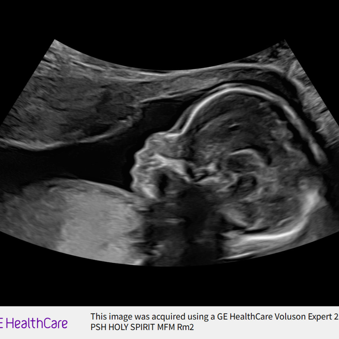 Photo shared by Awa for their Babylist baby registry.