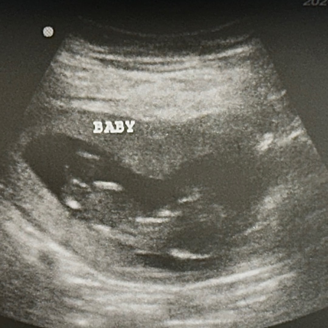 Photo shared by Amanda for their Babylist baby registry.