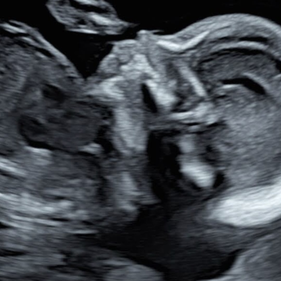 Photo shared by Amee for their Babylist baby registry.